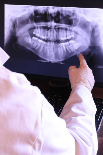 Best Emergency Dentist for Lost Fillings or Crowns in Grenada, MS